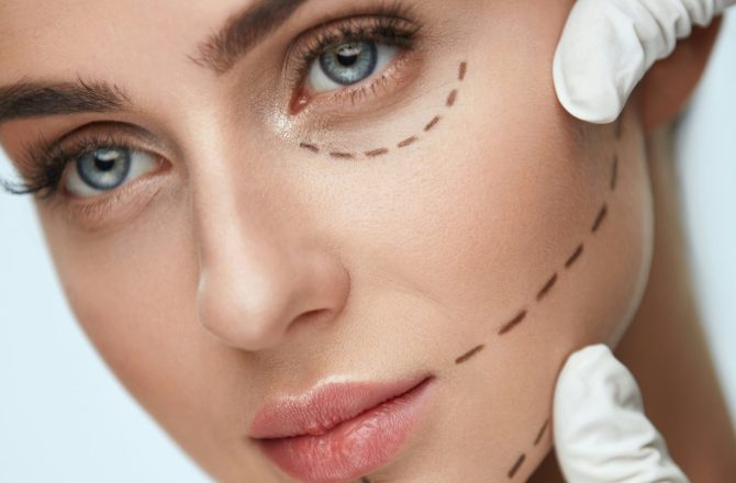 Unsure About Blepharoplasty? 5 Common Doubts Cleared!